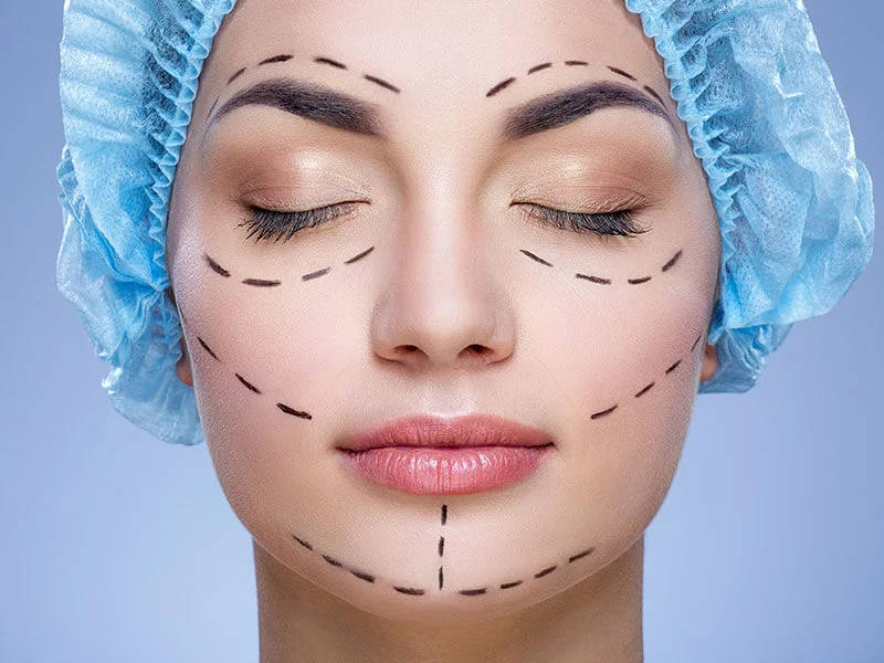 Plastic Surgery